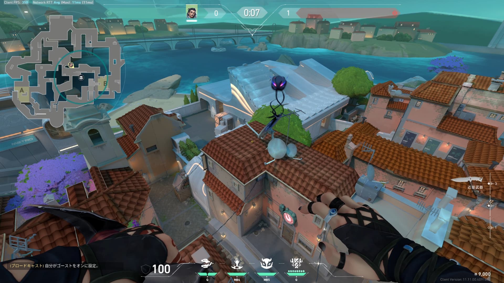 リンク・Bサイト・CT