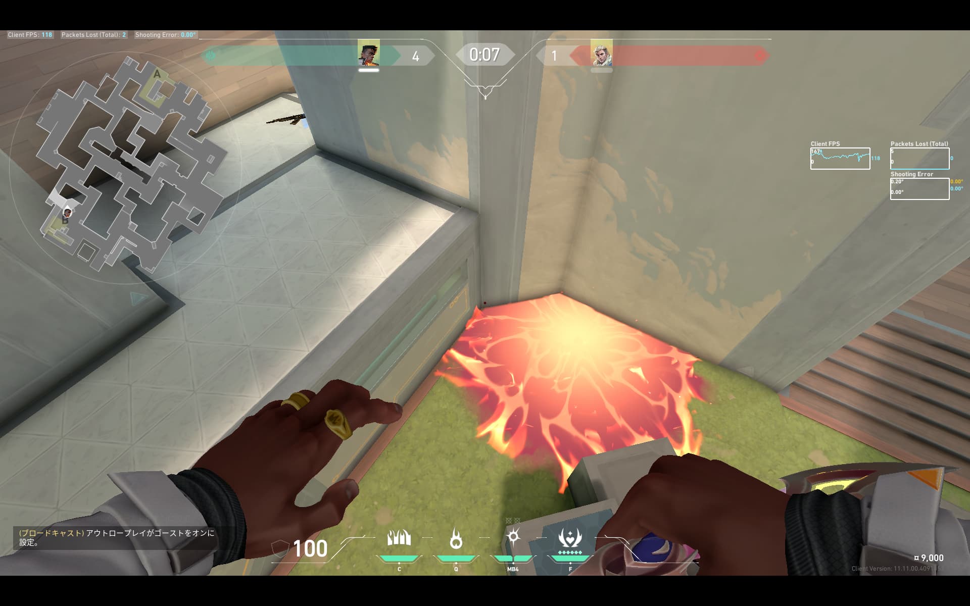 Bリテイク　バックサイト